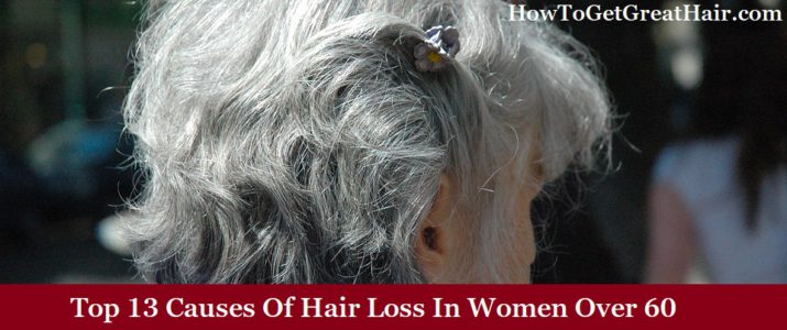 Top 13 Causes Of Hair Loss In Women Over 60