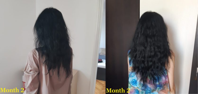 My Folexin (Foligen) Review – My #1 Recommendation For Hair Loss & Growth