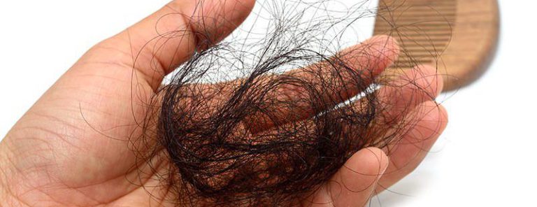 top-9-causes-of-hair-loss-in-women-over-50-how-to-get-great-hair