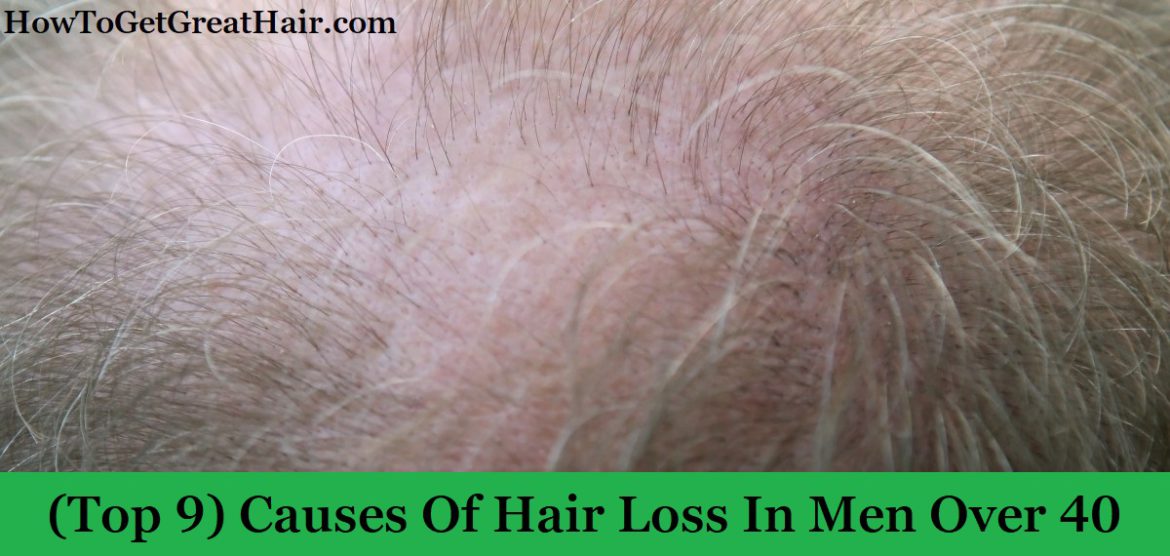 (Top 9) Causes Of Hair Loss In Men Over 40