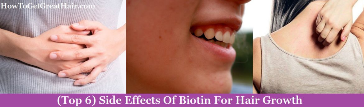 (Top 6) Side Effects Of Biotin For Hair Growth