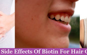 (Top 6) Side Effects Of Biotin For Hair Growth